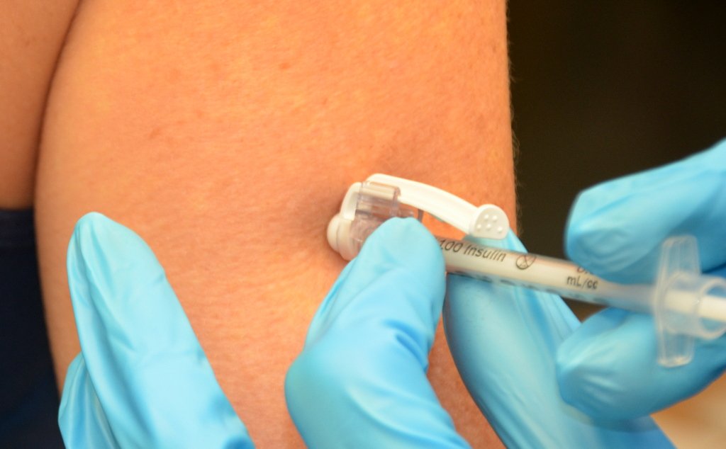 Une injection sous-cutanée pratiquée sur le bras avec une fine aiguille