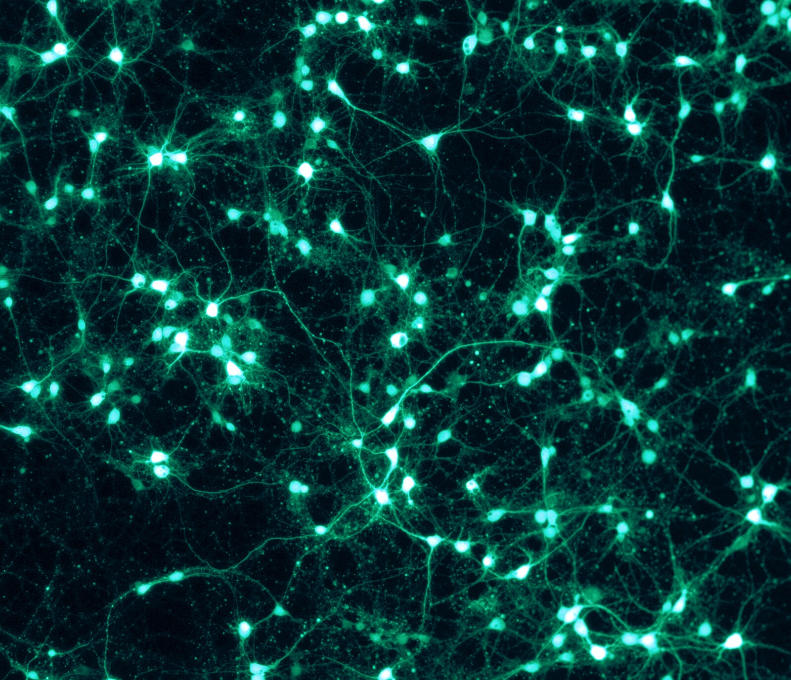 Neurones fluorescents verts vus au microscope, réseau dense de prolongements