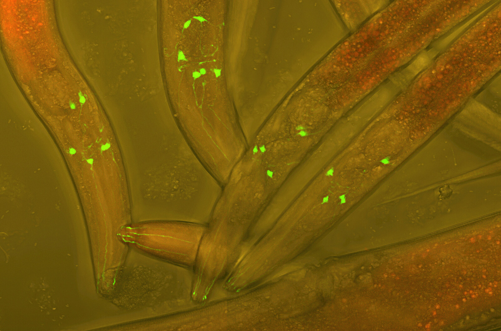 Cellule de Purkinje du cervelet vue au microscope, arborisation dendritique