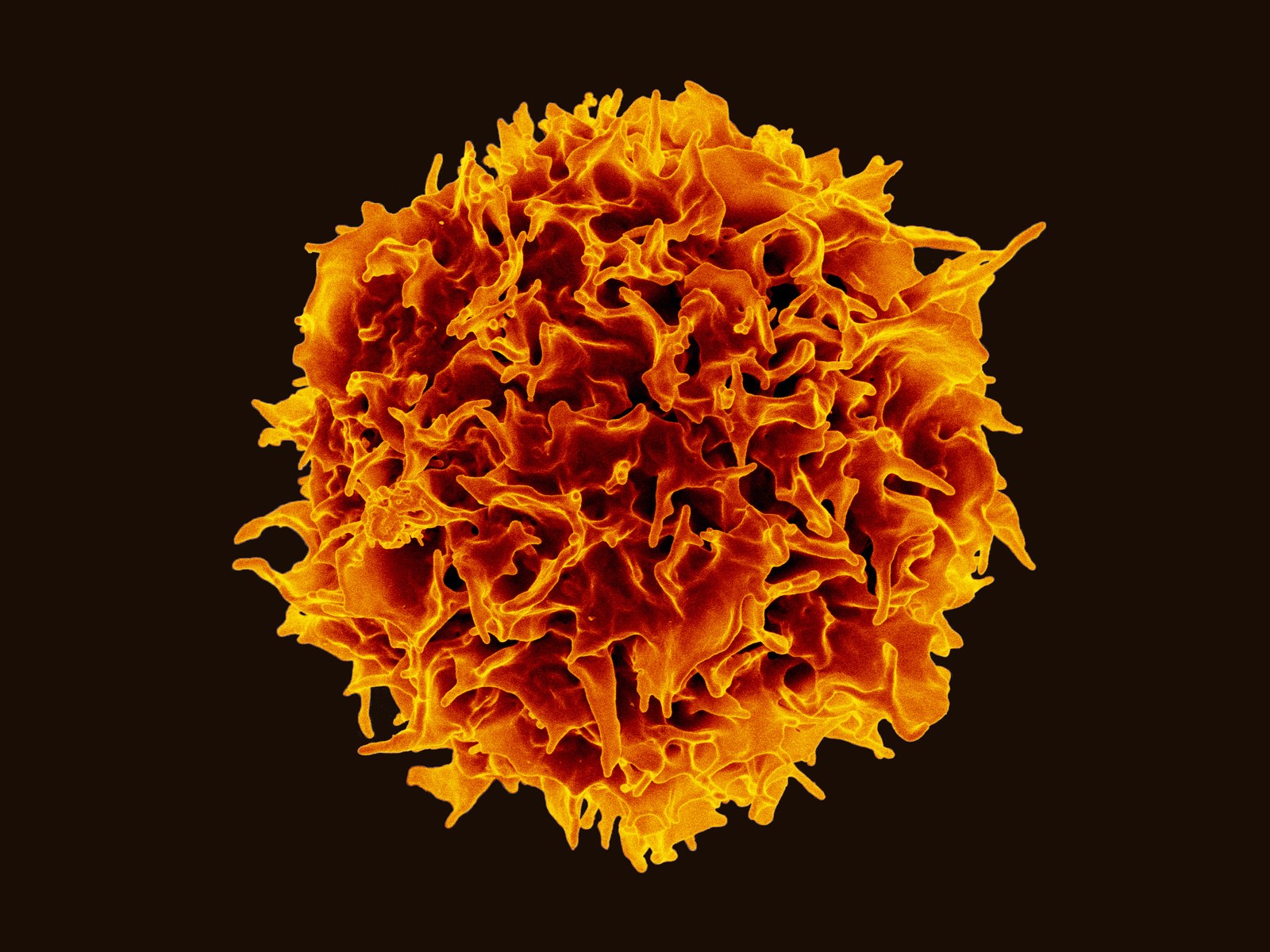 Un lymphocyte T vu au microscope électronique, boule orangée hérissée de replis sur fond noir