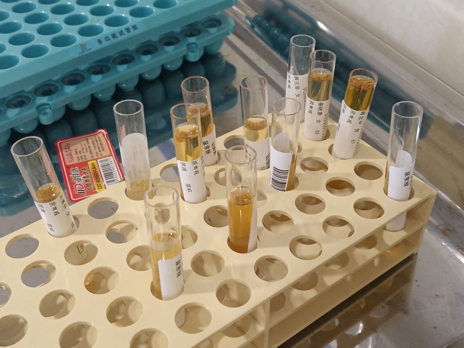 Une dizaine de tubes à essai remplis d’urine, alignés sur un portoir bleu dans un laboratoire