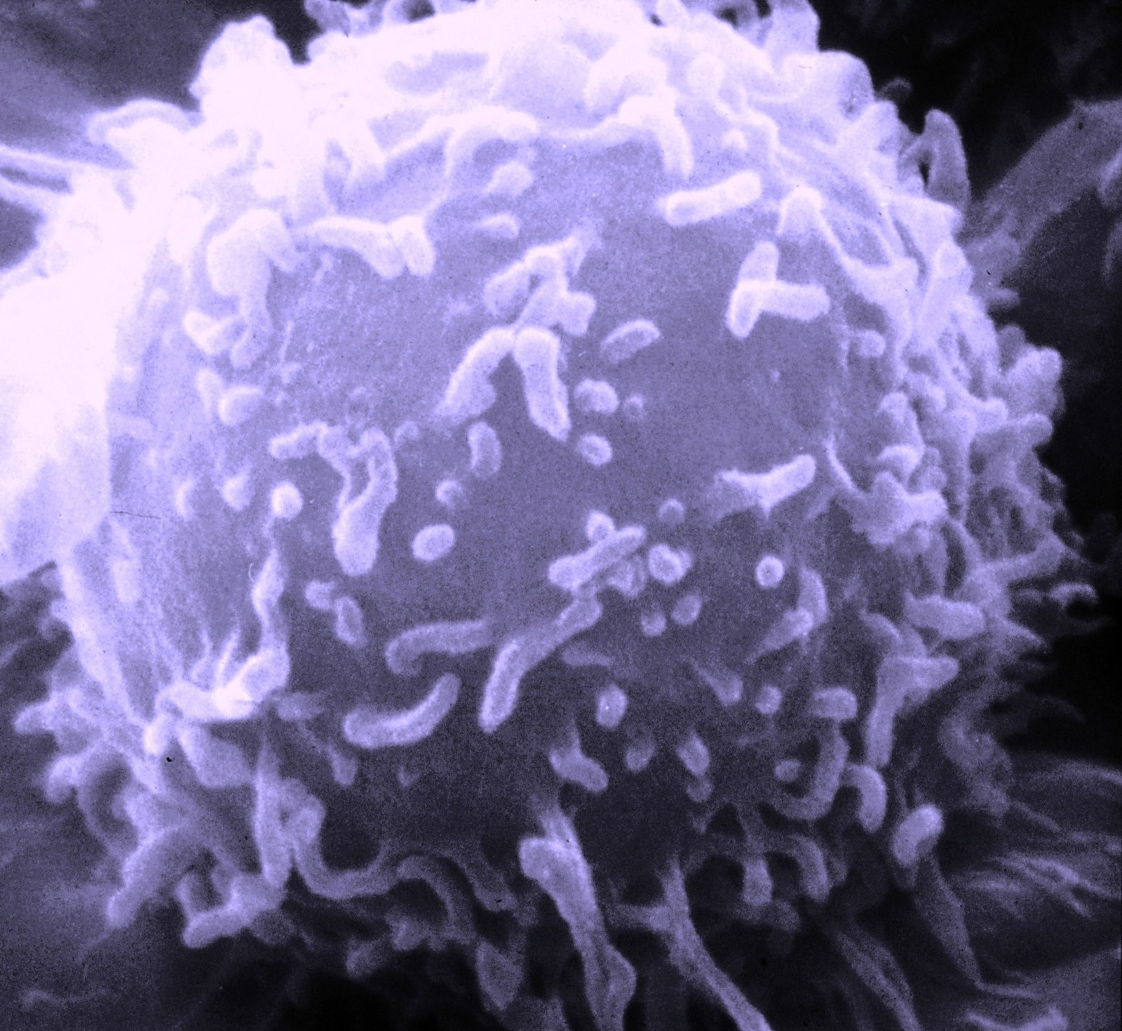 Un lymphocyte vu au microscope électronique à balayage, sphère violette couverte de petites excroissances